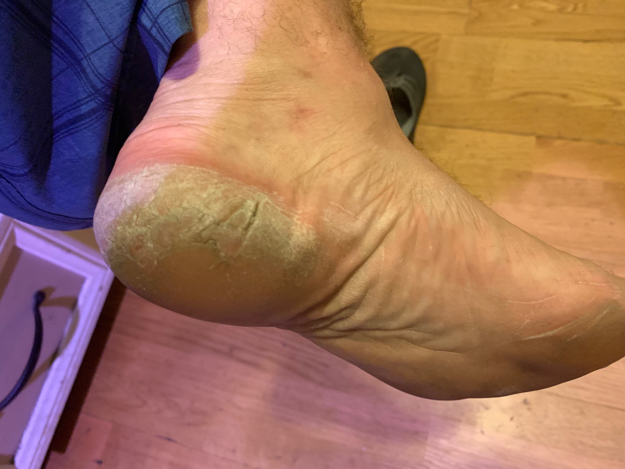 Do you have dry cracked hands, elbows or feet?  Make $$ trying a new product for 2 weeks