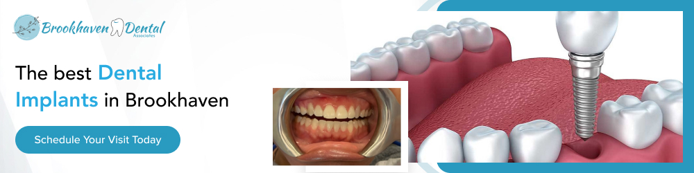 Brookhaven Dental Associates