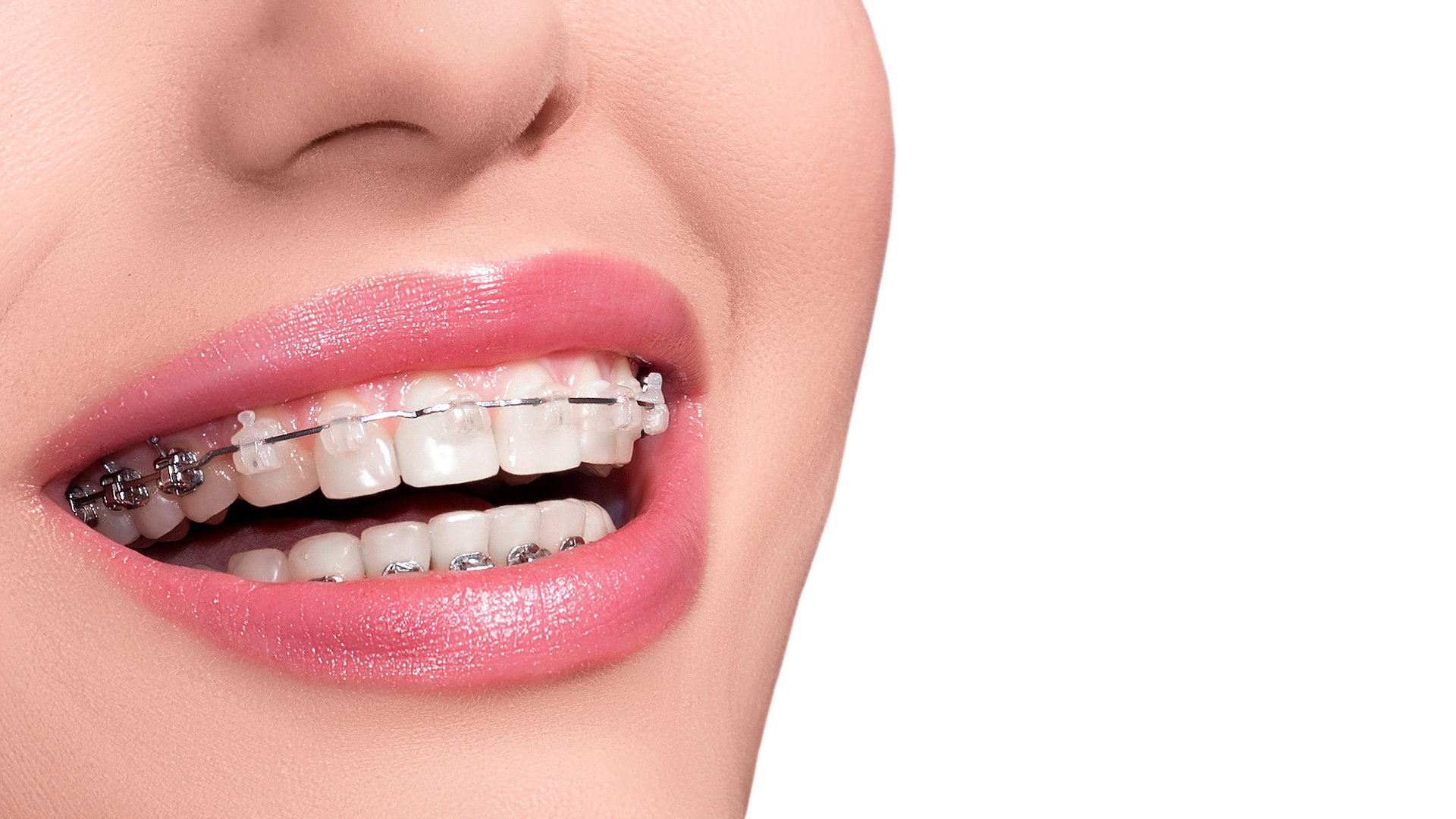 Best Orthodontist in Colorado Springs