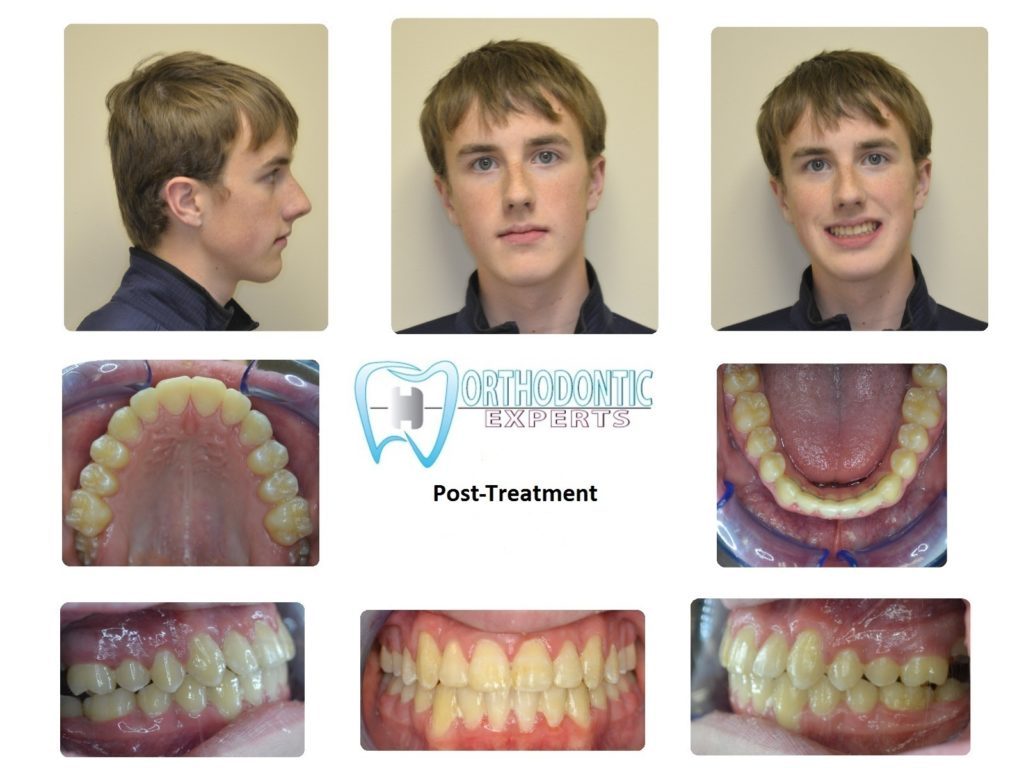 Best Orthodontist in Colorado Springs