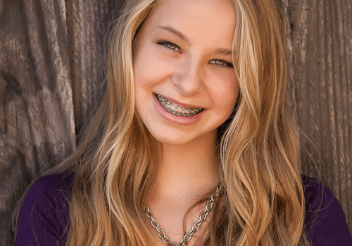 Best Braces in Colorado Springs