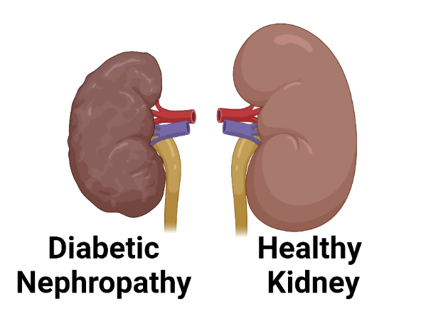 Trusted Nephrologist Houston Residents Rely On