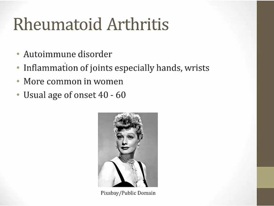 Rheumatoid Arthritis My Wiki