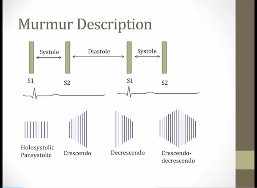 22 Heart Murmurs - My Wiki