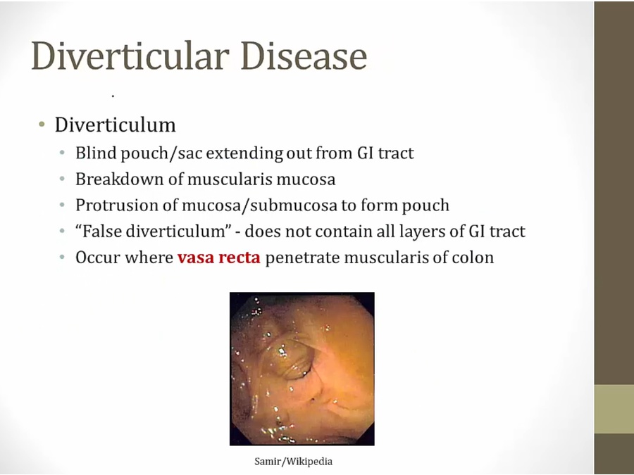 24 Intestinal Disorders - My Wiki