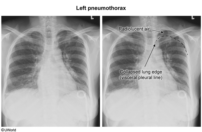 21 Pulmonary - My Wiki