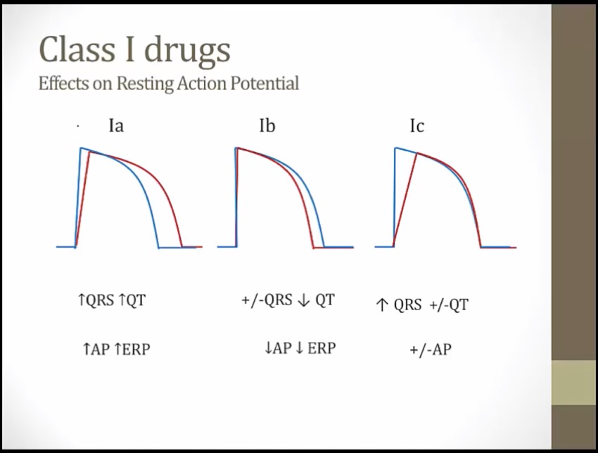 21 Antiarrhythmics - My Wiki