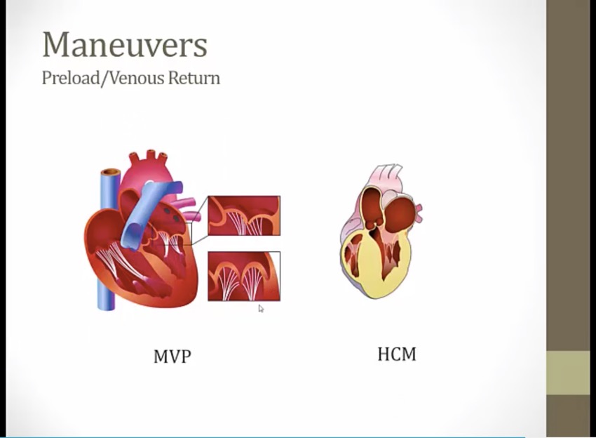 22 Heart Murmurs My Wiki