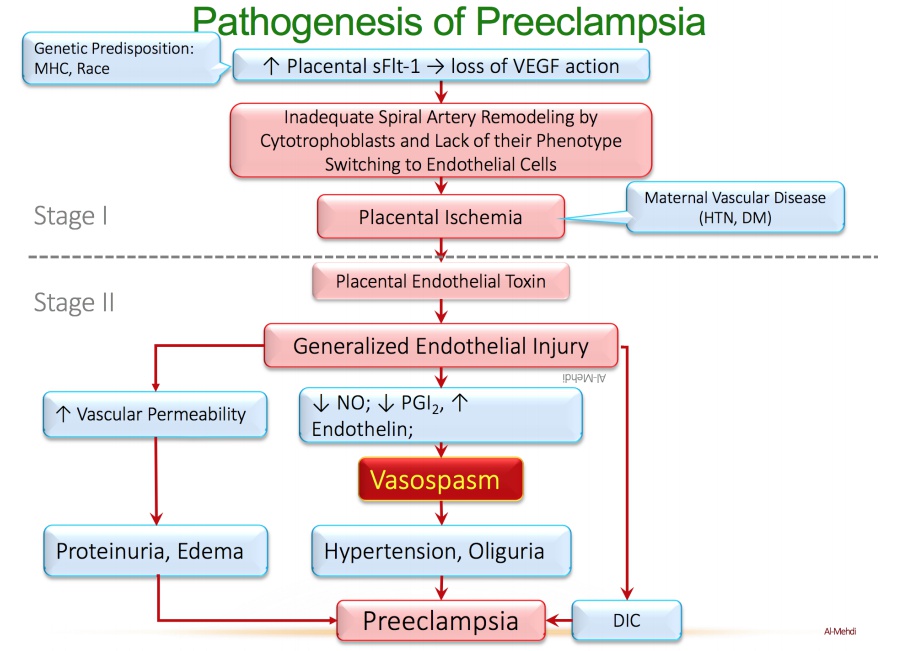 Preeclampsia - My Wiki