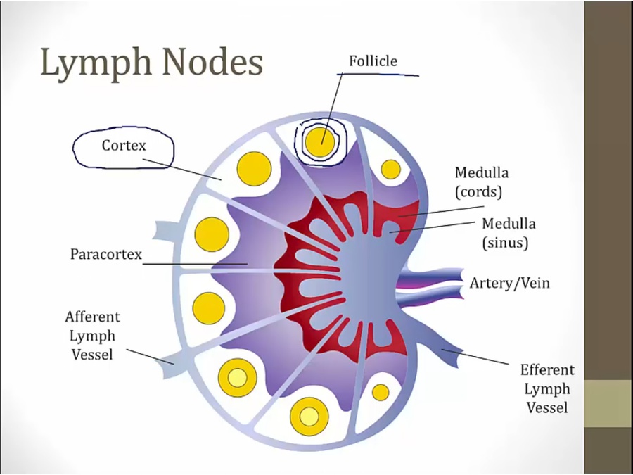 19 Nonhodgkin Lymphoma - My Wiki