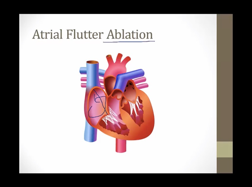 15 EKG Others My Wiki