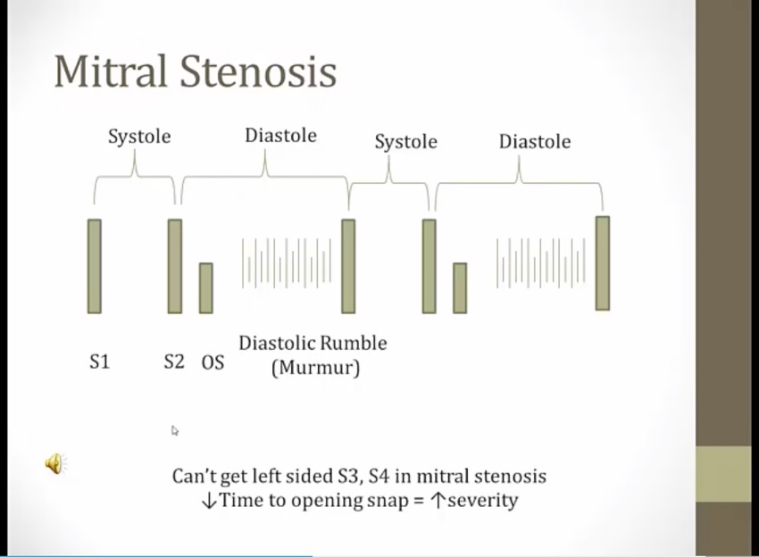 22 Heart Murmurs - My Wiki