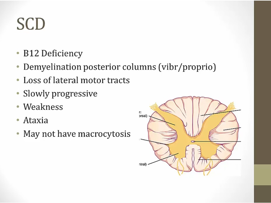 08 Spinal Cord Syndromes My Wiki
