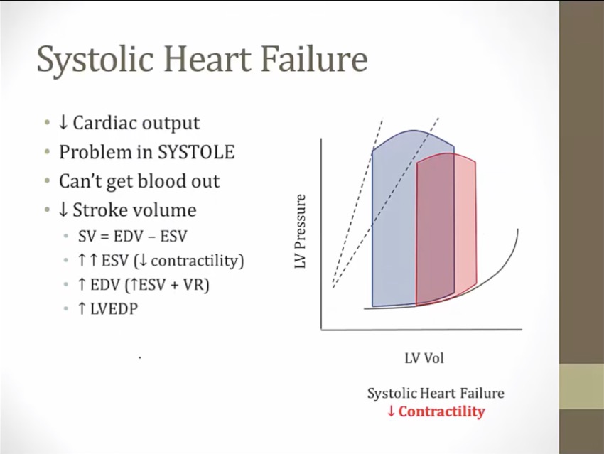 25-systolic-diastolic-hf-my-wiki