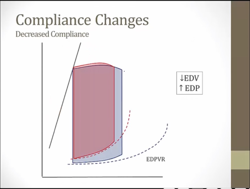 06-pv-loop-my-wiki