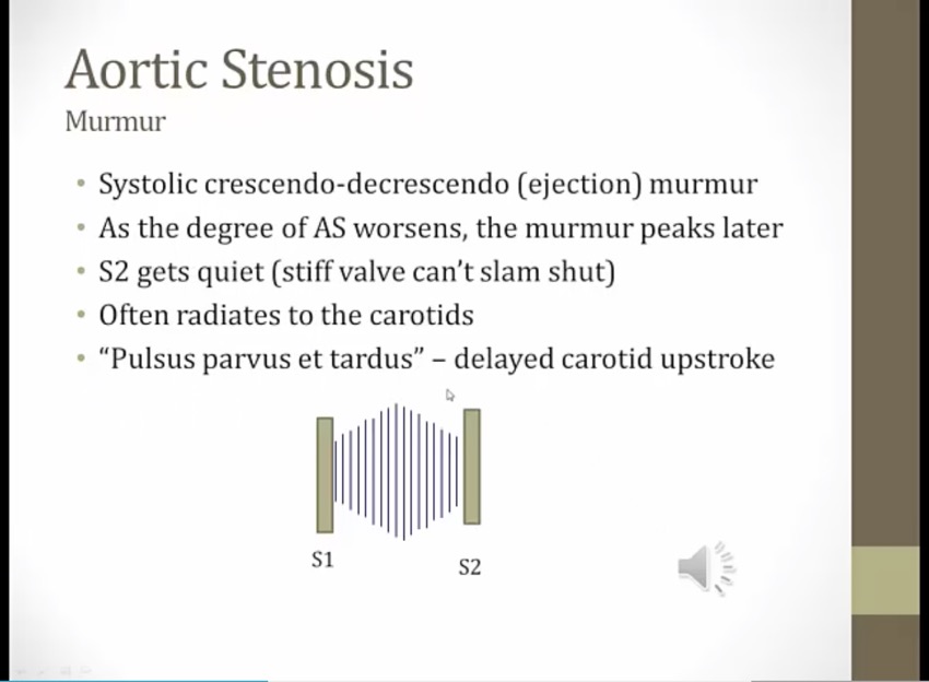 22 Heart Murmurs - My Wiki