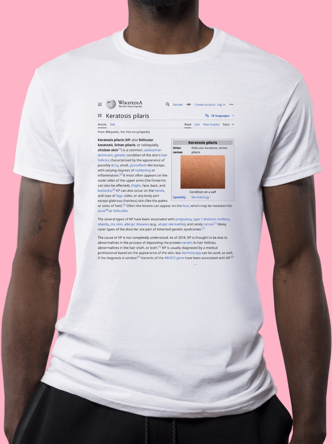 Keratosis_pilaris Wikipedia Shirt